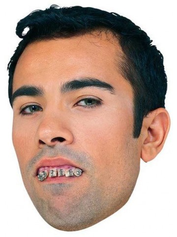Кривые зубы с брекетами